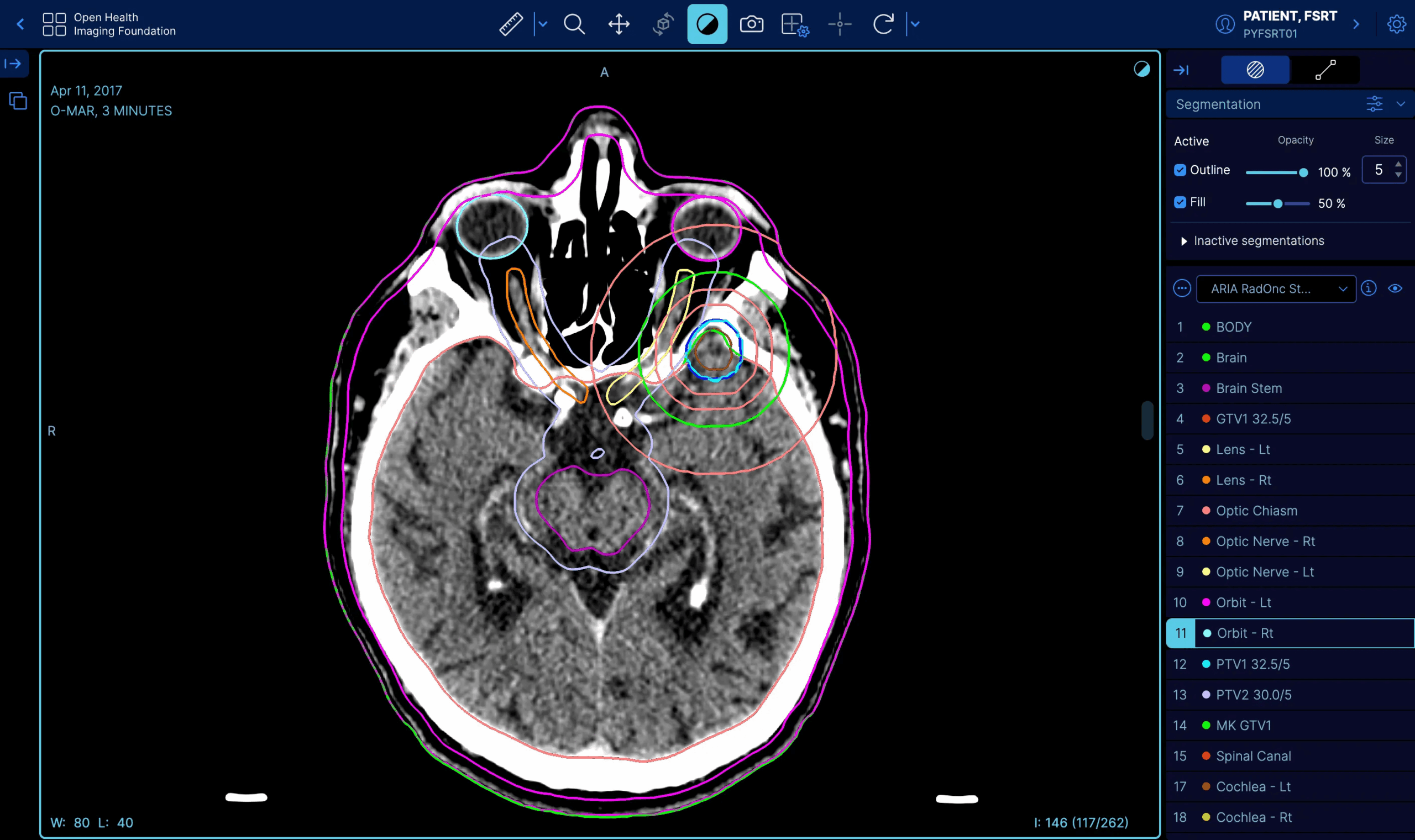 OHIF Viewer in action